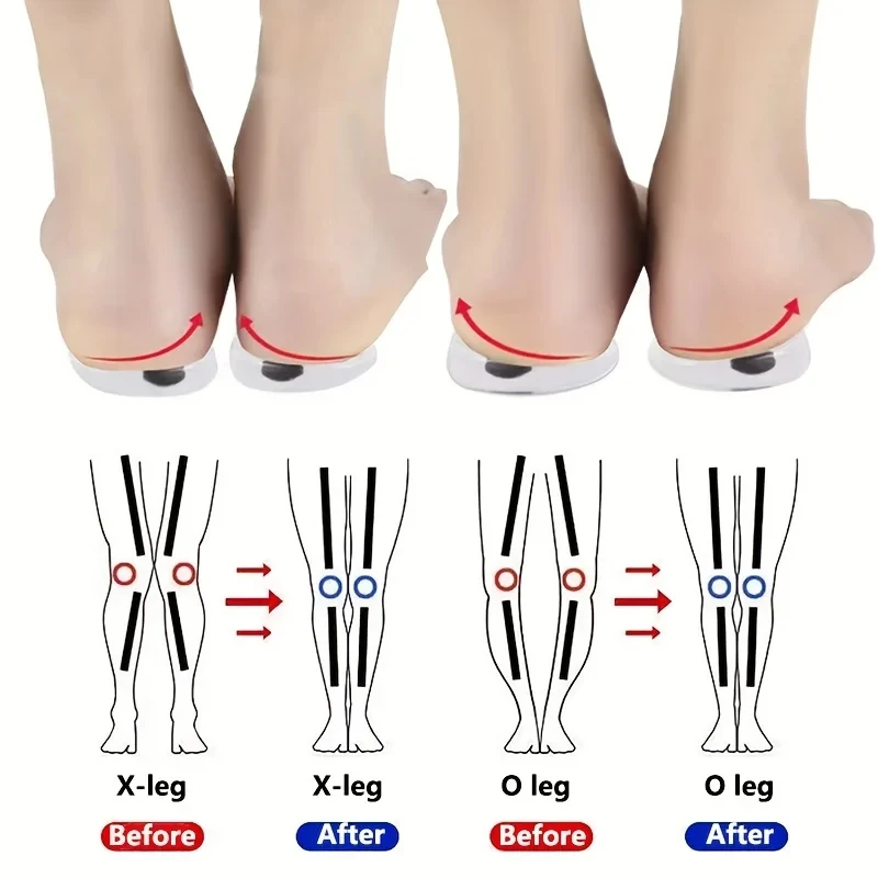 1 paar Orthopädische Einlegeso – Women Shoes Types Bewertung und Preis